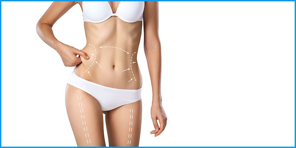 liposuccion-complete-tunisie-femme