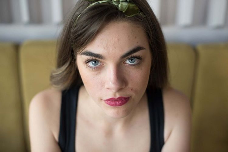 Tout ce que vous devez savoir pour faire disparaître les cicatrices d'acné | So Busy Girls