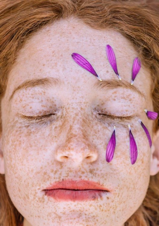 visage-femme-taches-de-rousseur