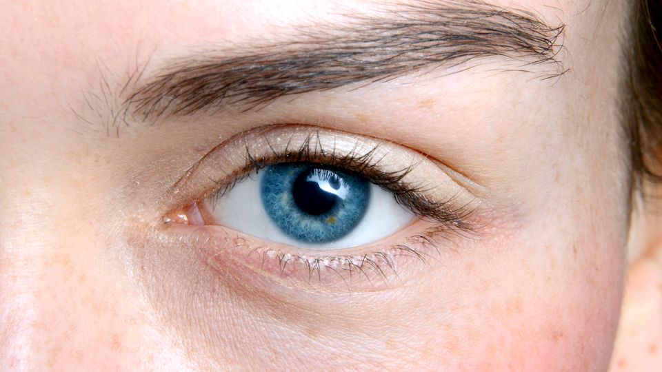 poches-sous-les-yeux-femme
