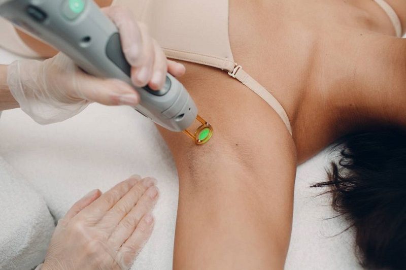 rendez-vous-pour-epilation-laser