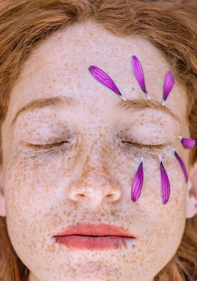 visage-femme-taches-de-rousseur